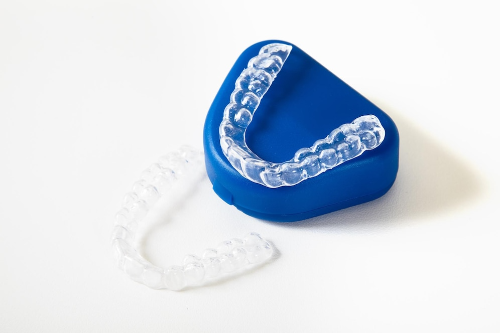 mouth guards tips at Melbourne East Prosthodontics